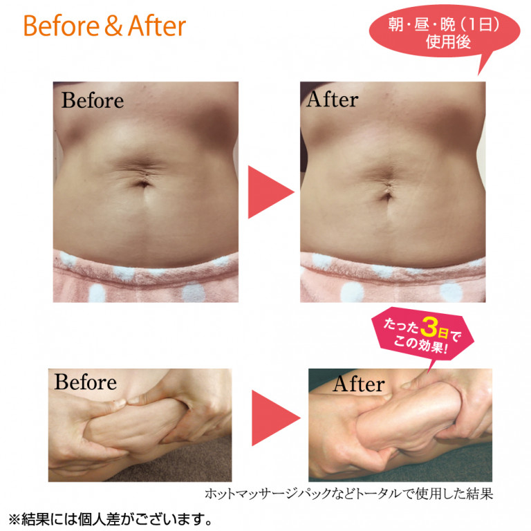 【ベストライフ】ボディミルク 200ml セルライトケア ボディミルク - 株式会社ベストライフ - ベストライフ オンラインショップ